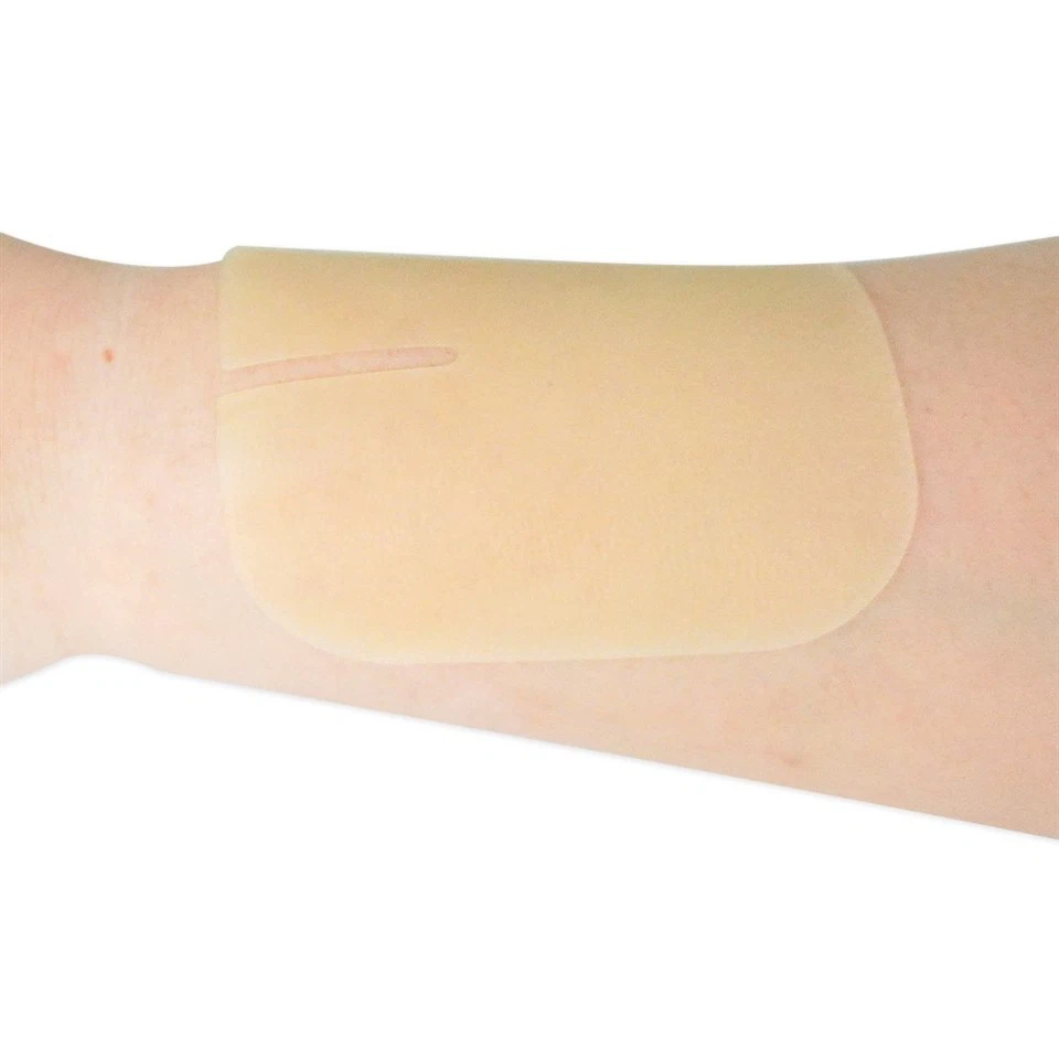 Waterproof Hydrocolloid Wound Dressing Adhesive Hydrocolloid Bandages For Pressure Ulcer Bed Sore Light Exudate